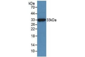 WB of Protein Standard: different control antibodies against Highly purified E. (MGEA5 ELISA Kit)
