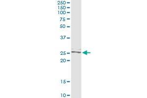 Immunoprecipitation of TWIST2 transfected lysate using anti-TWIST2 monoclonal antibody and Protein A Magnetic Bead , and immunoblotted with TWIST2 MaxPab rabbit polyclonal antibody. (TWIST2 antibody  (AA 1-160))