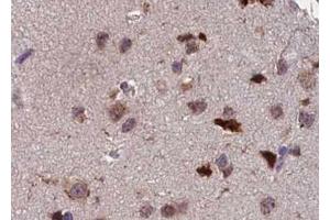 ABIN6267391 at 1/100 staining human brain tissue sections by IHC-P. (ATF2 antibody  (pThr55, pThr73))