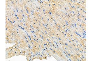 ABIN6260772 and ABIN6266926 at 1/100 staining Mouse heart tissue by IHC-P. (CERKL antibody  (Internal Region))