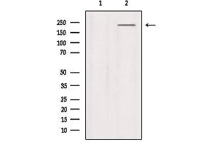 Western blot analysis of extracts from Mouse lung, using Na+ CP type IXalpha Antibody. (SCN9A antibody  (Internal Region))