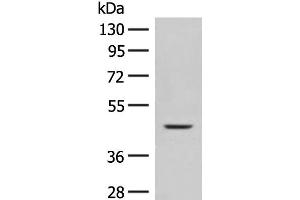 Western blot analysis of Mouse liver tissue lysate using FUT10 Polyclonal Antibody at dilution of 1:450 (FUT10 antibody)