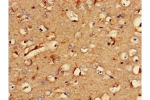 Immunohistochemistry of paraffin-embedded human brain tissue using ABIN7146282 at dilution of 1:100 (RCAN2 antibody  (AA 88-197))