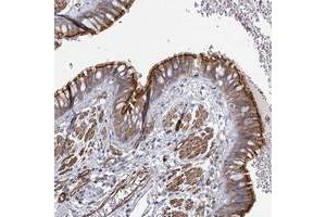 Immunohistochemical staining of human bronchus with C11orf60 polyclonal antibody  shows moderate cytoplasmic and membrane positivity in respiratory epithelial cells at 1:500-1:1000 dilution. (IFT46 antibody)