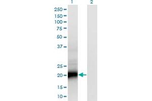 Western Blot analysis of SMUG1 expression in transfected 293T cell line by SMUG1 monoclonal antibody (M07), clone 4D5. (SMUG1 antibody  (AA 1-177))