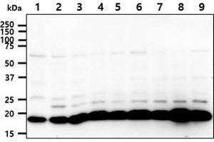 The cell lysates (40ug) were resolved by SDS-PAGE, transferred to PVDF membrane and probed with anti-human SSU72 antibody (1:1000). (SSU72 antibody)