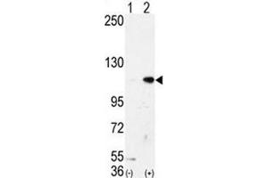 Western blot analysis of LSD1 antibody and 293 cell lysate either nontransfected (Lane 1) or transiently transfected with the AOF2/LSD1 gene (2).