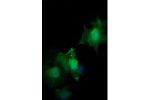 Image no. 4 for anti-HRas proto-oncogene, GTPase (HRAS) antibody (ABIN1498716)