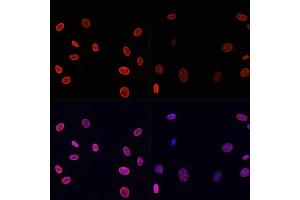 Immunofluorescence analysis of NIH/3T3 cells using Acetyl-Histone H4-K91 antibody (ABIN7267748) at dilution of 1:100.