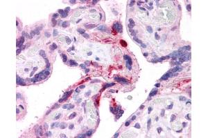 Immunohistochemistry (IHC) image for anti-Leucine Rich Repeat Containing 8 Family, Member B (LRRC8B) (Middle Region) antibody (ABIN502806) (LRRC8B antibody  (Middle Region))