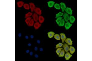 ABIN6260161 and ABIN6279063 staining Hela cells by IF/ICC. (AWAT2 antibody  (Internal Region))