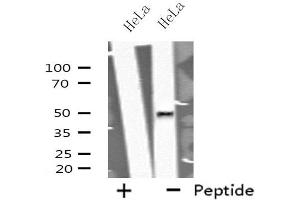 Western blot analysis of extracts from HeLa cells using GORASP2 antibody. (GORASP2 antibody  (Internal Region))
