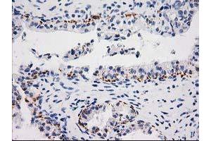 Image no. 1 for anti-Monoglyceride Lipase (MGLL) antibody (ABIN1499441) (MGLL antibody)
