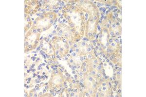 Immunohistochemistry (IHC) image for anti-Deleted in Liver Cancer 1 (DLC1) (AA 204-463) antibody (ABIN6219061) (DLC1 antibody  (AA 204-463))