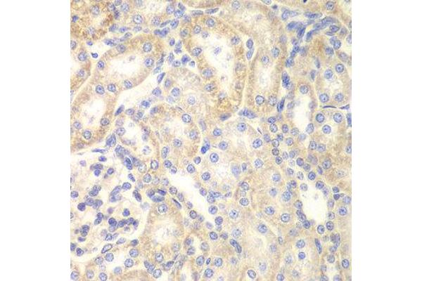 DLC1 antibody  (AA 204-463)