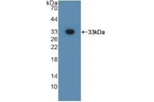 Detection of Recombinant GPC3, Mouse using Polyclonal Antibody to Glypican 3 (GPC3) (Glypican 3 antibody  (AA 344-559))