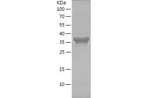 Western Blotting (WB) image for Eukaryotic Translation Elongation Factor 1 alpha 2 (EEF1A2) (AA 373-463) protein (His-IF2DI Tag) (ABIN7122827) (EEF1A2 Protein (AA 373-463) (His-IF2DI Tag))