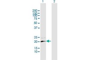 Western Blot analysis of GUCA1C expression in transfected 293T cell line by GUCA1C MaxPab polyclonal antibody. (GUCA1C antibody  (AA 1-209))