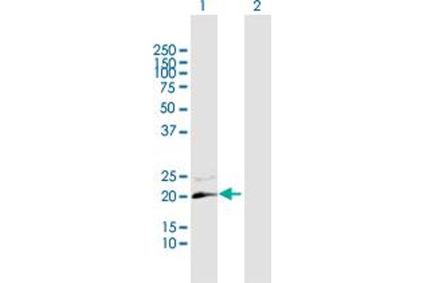 GUCA1C antibody  (AA 1-209)