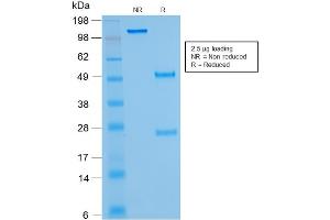 SDS-PAGE Analysis of Purified IGKC Mouse Recombinant Monoclonal Antibody ABIN6383813. (Recombinant IGKC antibody)
