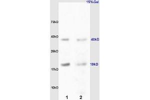 L1 rat kidney lysates L2 rat liver lysates probed with Anti RCL/c Myc responsive Polyclonal Antibody, Unconjugated (ABIN872485) at 1:200 overnight at 4 °C. (RCL antibody  (AA 101-174))
