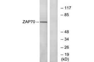 Western blot analysis of extracts from Jurkat cells, using ZAP-70 (Ab-319) Antibody. (ZAP70 antibody  (AA 286-335))