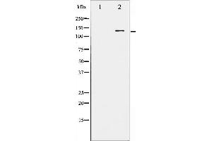 Western blot analysis of FGFR1 phosphorylation expression in EGF treated HepG2 whole cell lysates,The lane on the left is treated with the antigen-specific peptide. (FGFR1 antibody  (pTyr766))