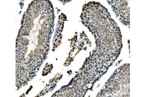 IHC analysis of LSM8 using anti-LSM8 antibody (ABIN7599579).