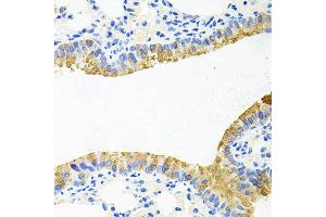 Immunohistochemistry of paraffin-embedded mouse lung using TOB2 antibody at dilution of 1:100 (x40 lens).