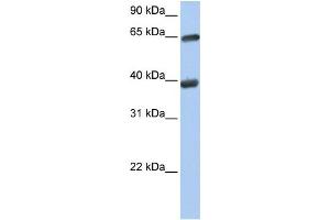 WB Suggested Anti-TKT  Antibody Titration: 0. (TKT antibody  (N-Term))