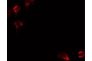 ABIN6274863 staining HeLa by IF/ICC. (ARG2 antibody  (C-Term))