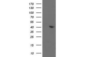 HEK293T cells were transfected with the pCMV6-ENTRY control (Left lane) or pCMV6-ENTRY ALDOB (Right lane) cDNA for 48 hrs and lysed. (ALDOB antibody)