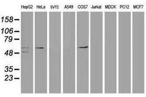Image no. 3 for anti-Tumor Protein P53 (TP53) antibody (ABIN1499969)