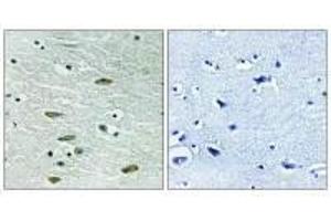 Immunohistochemistry analysis of paraffin-embedded human brain tissue using IGF1R (Ab-1346) antibody. (IGF1R antibody  (Tyr1346))