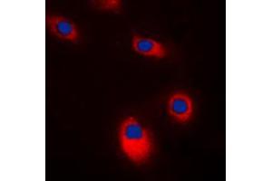Immunofluorescent analysis of c-SRC staining in K562 cells.