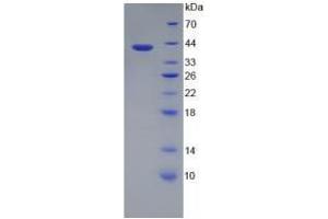 SDS-PAGE analysis of Human TFR2 Protein. (Transferrin Receptor 2 Protein (TFR2))
