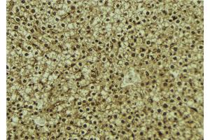 ABIN6273087 at 1/100 staining Mouse liver tissue by IHC-P. (VPS37A antibody  (N-Term))