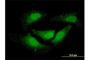 Immunofluorescence of monoclonal antibody to NR0B1 on HeLa cell. (NR0B1 antibody  (AA 361-470))