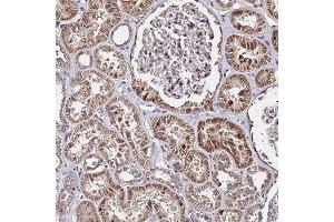 Immunohistochemical staining of human kidney with WNK4 polyclonal antibody ( Cat # PAB28012 ) shows strong cytoplasmic and nuclear positivity in cells in tubules at 1:20 - 1:50 dilution.