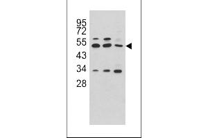 Western blot analysis of CPA4 antibody in Hela, CEM and NCI-H460 cell line lysates (35ug/lane) (CPA4 antibody  (C-Term))