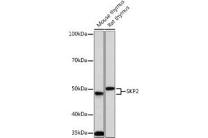 Western blot analysis of extracts of various cell lines, using SKP2 Rabbit mAb (ABIN1680764, ABIN3018459, ABIN3018460 and ABIN7101615) at 1:1000 dilution. (SKP2 antibody)