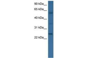 Image no. 1 for anti-Bone Morphogenetic Protein 6 (BMP6) (AA 46-95) antibody (ABIN6746538)