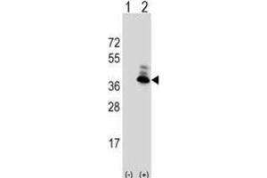 Western Blotting (WB) image for anti-Aspartoacylase (ASPA) antibody (ABIN3002840) (ASPA antibody)
