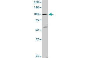 SCYL2 MaxPab rabbit polyclonal antibody. (SCYL2 antibody  (AA 1-929))
