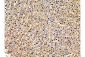 ABIN6258077 and ABIN6275814 at 1/100 staining rat liver tissue by IHC-P.