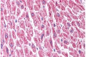 Human Heart (formalin-fixed, paraffin-embedded) stained with HDAC8 antibody ABIN214773 at 5 ug/ml followed by biotinylated goat anti-rabbit IgG secondary antibody ABIN481713, alkaline phosphatase-streptavidin and chromogen. (HDAC8 antibody  (C-Term))