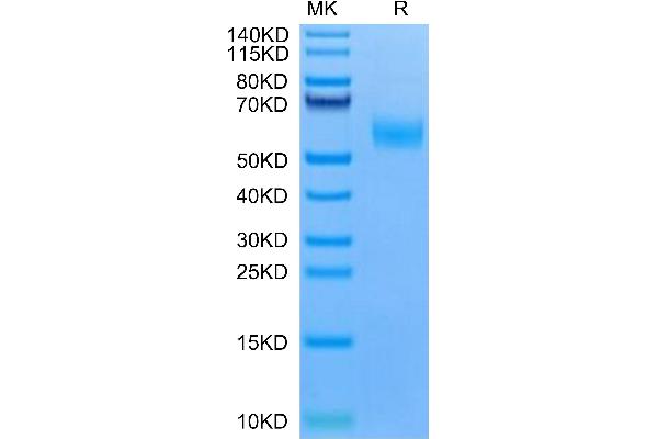 Ectodysplasin A2 Receptor Protein (EDA2R) (AA 1-138) (Fc Tag)
