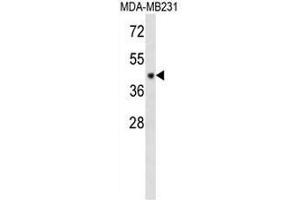 Western blot analysis in MDA-MB231 cell line lysates using CF150 Antibody (Center) Cat. (C6orf150 antibody  (Middle Region))