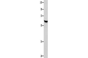 Western Blotting (WB) image for anti-DnaJ (Hsp40) Homolog, Subfamily C, Member 7 (DNAJC7) antibody (ABIN2421969)
