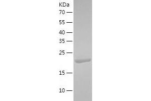 Western Blotting (WB) image for StAR-Related Lipid Transfer (START) Domain Containing 5 (STARD5) (AA 1-213) protein (His tag) (ABIN7289051) (STARD5 Protein (AA 1-213) (His tag))